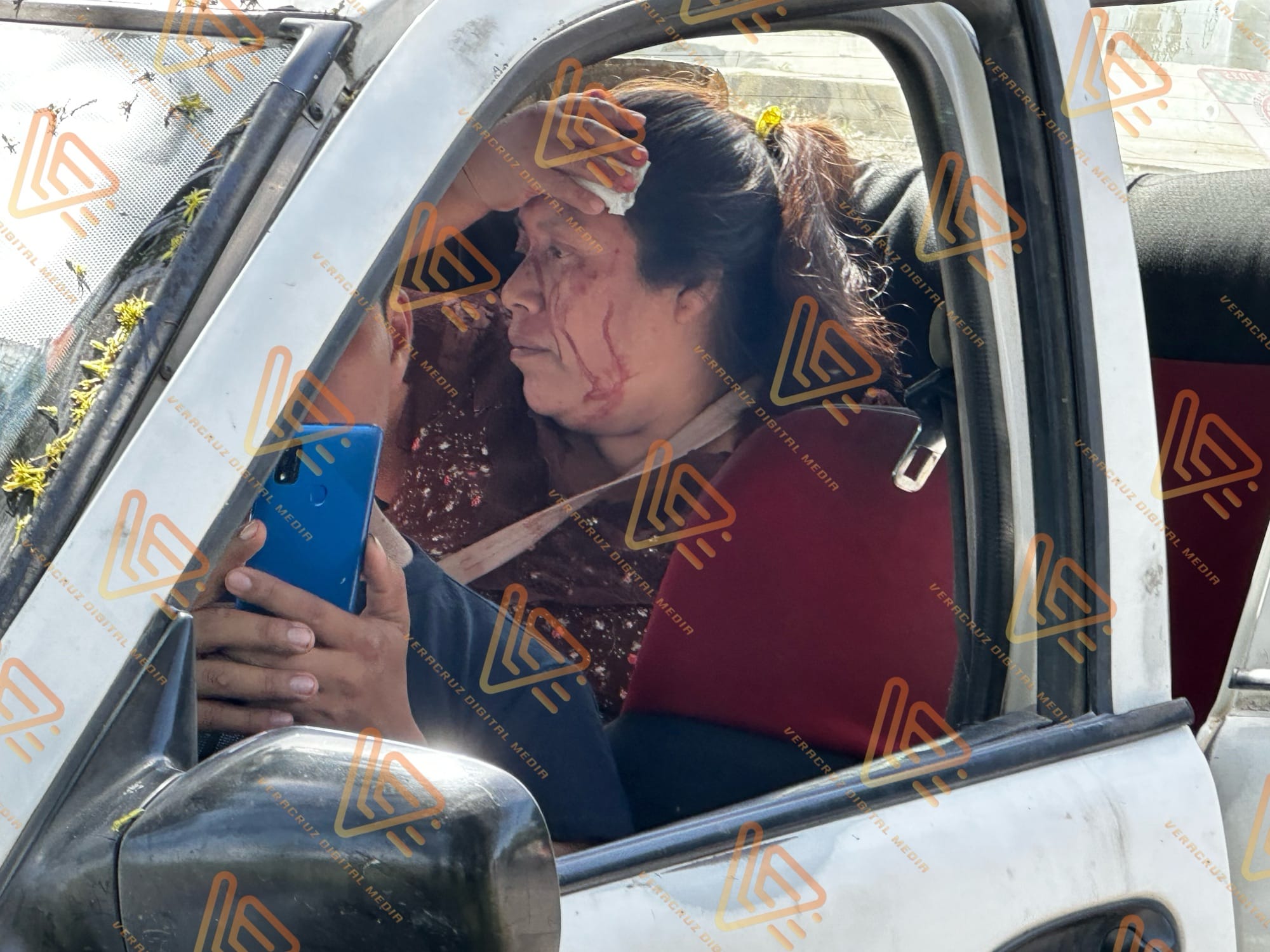 Choque de Taxi deja heridos en la Tortuga