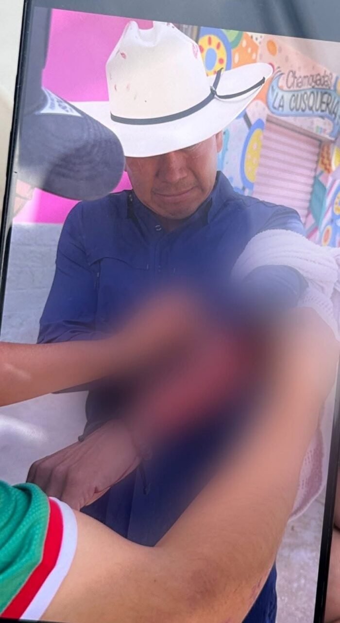 Oaxaca | Alcalde de Miahuatlán resulta lesionado tras ataque