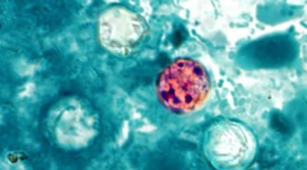 México emite aviso de viaje por ciclosporiasis en EE.UU